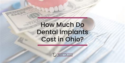 dental implants cost miamisburg oh